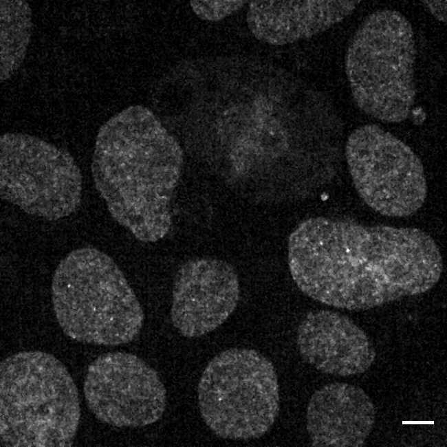 [object Object] thumbnail