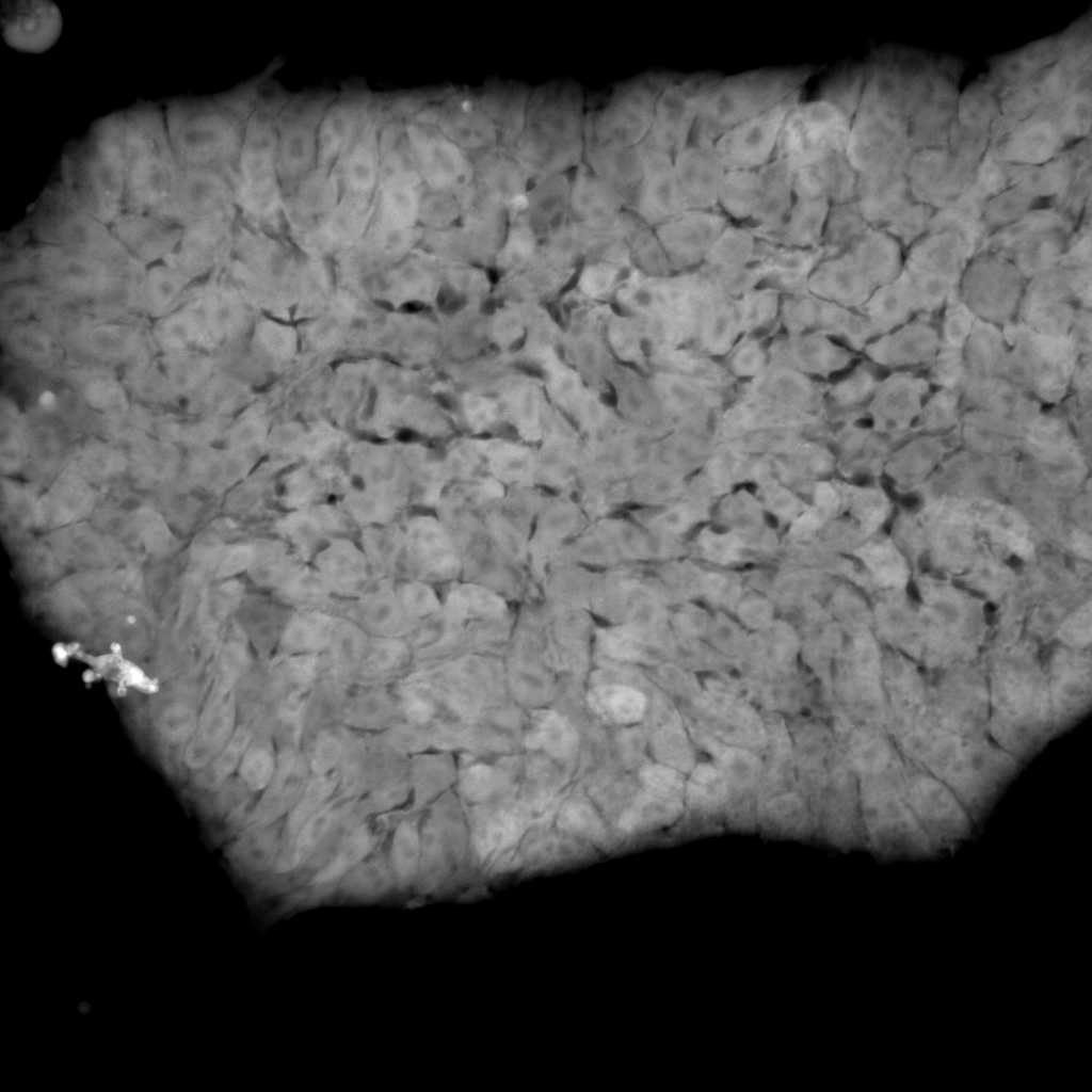 [object Object] thumbnail