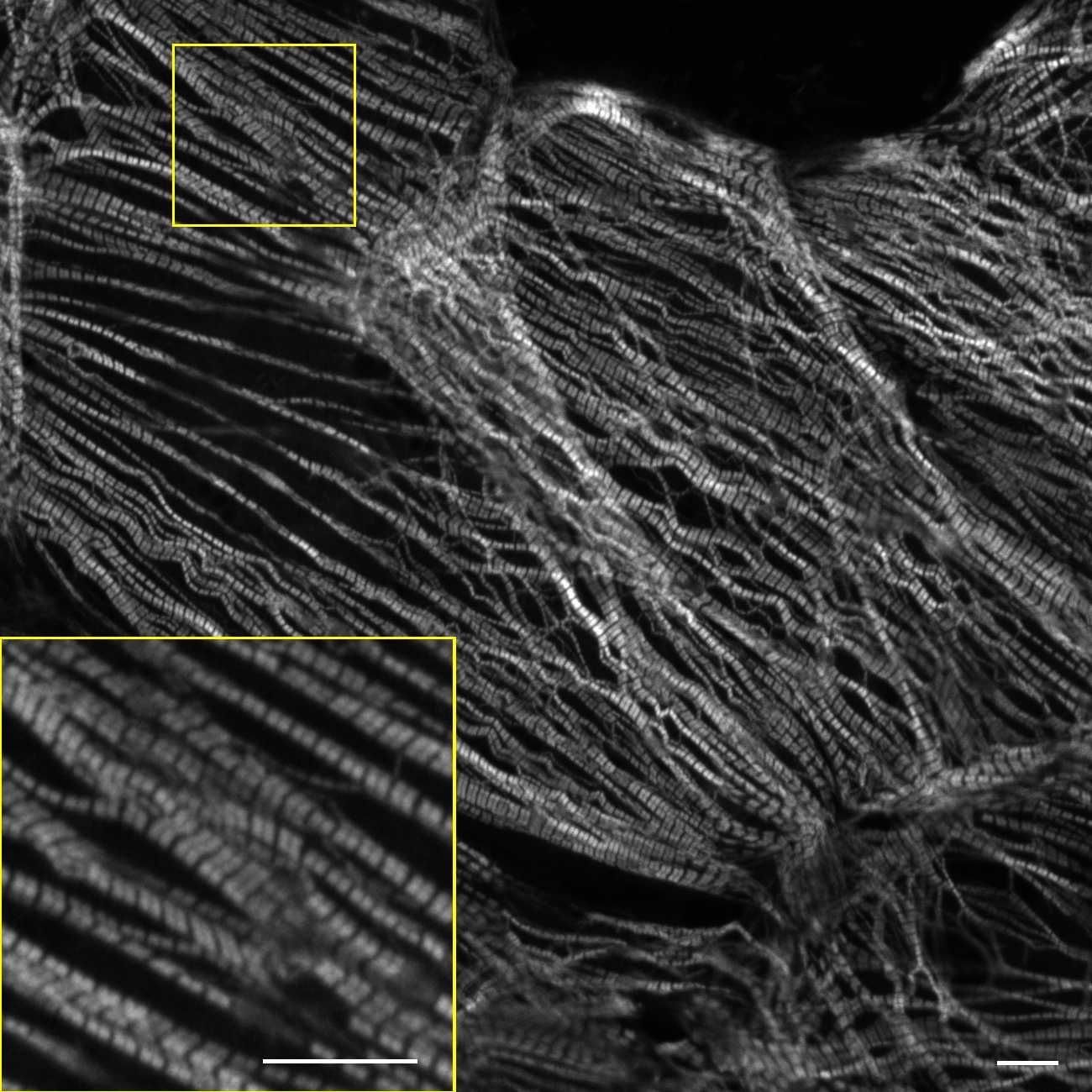 [object Object] thumbnail