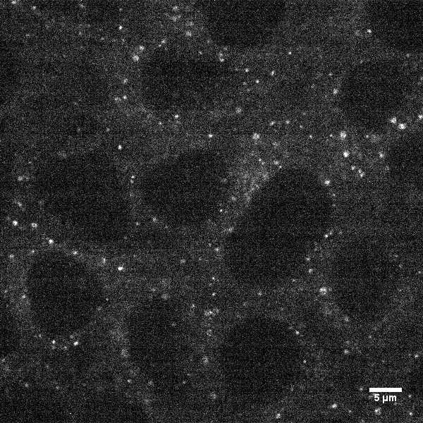 [object Object] thumbnail