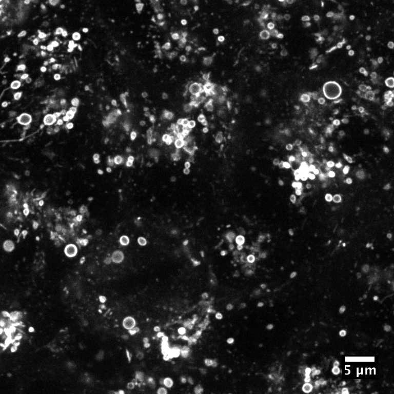 [object Object] thumbnail