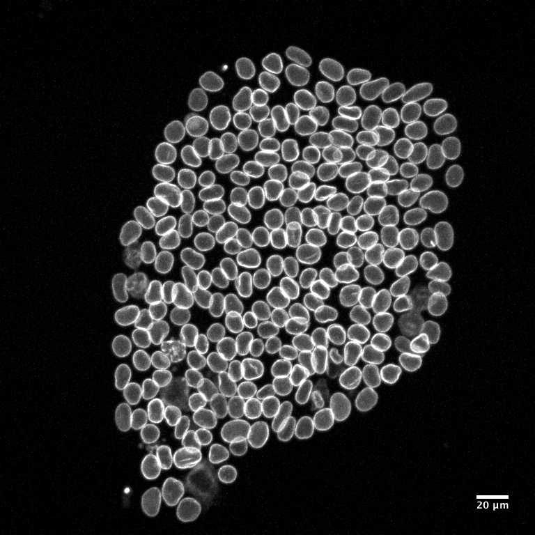 [object Object] thumbnail