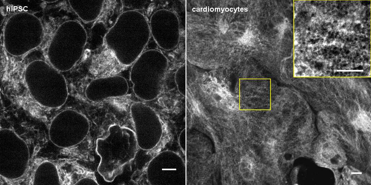 [object Object] thumbnail