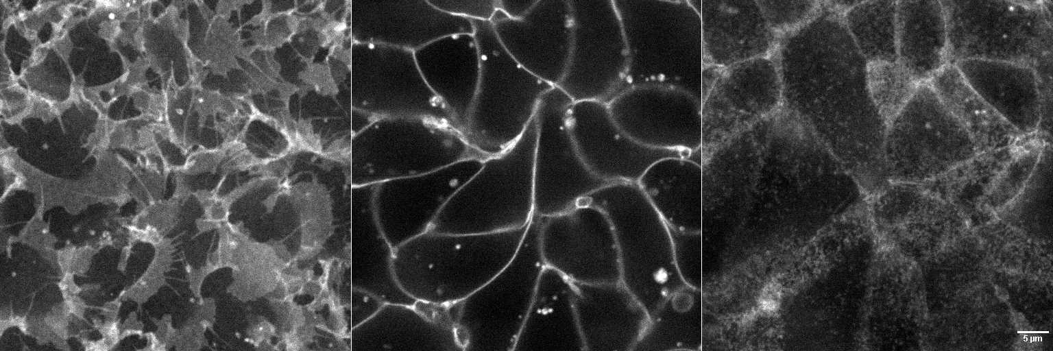 [object Object] thumbnail