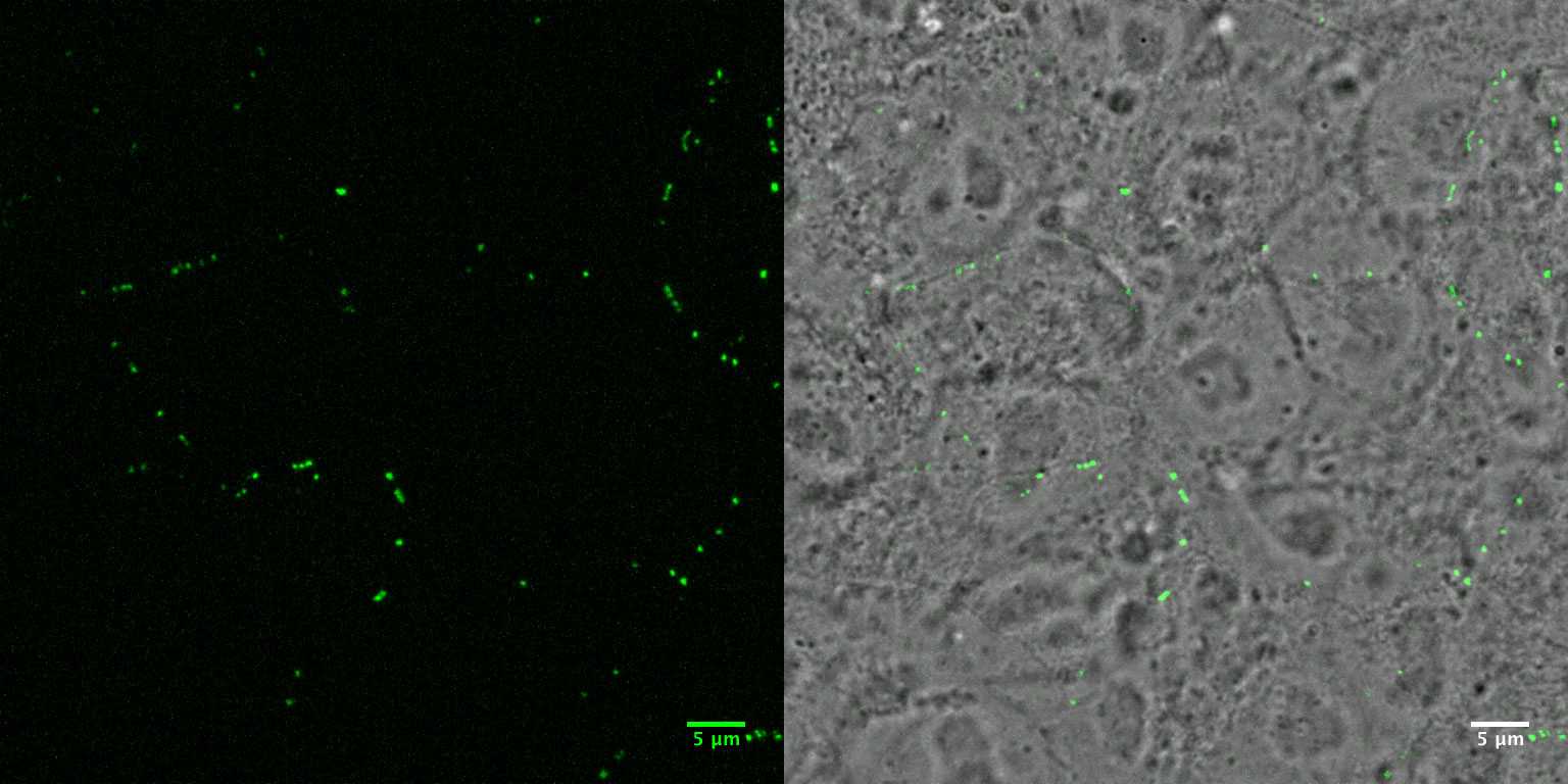 [object Object] thumbnail