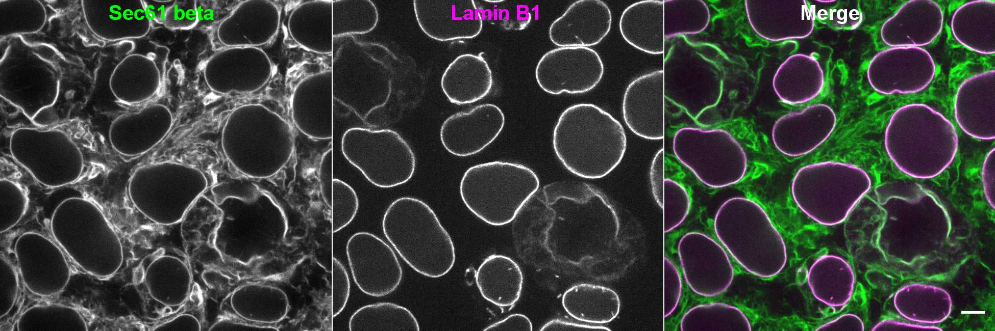 [object Object] thumbnail